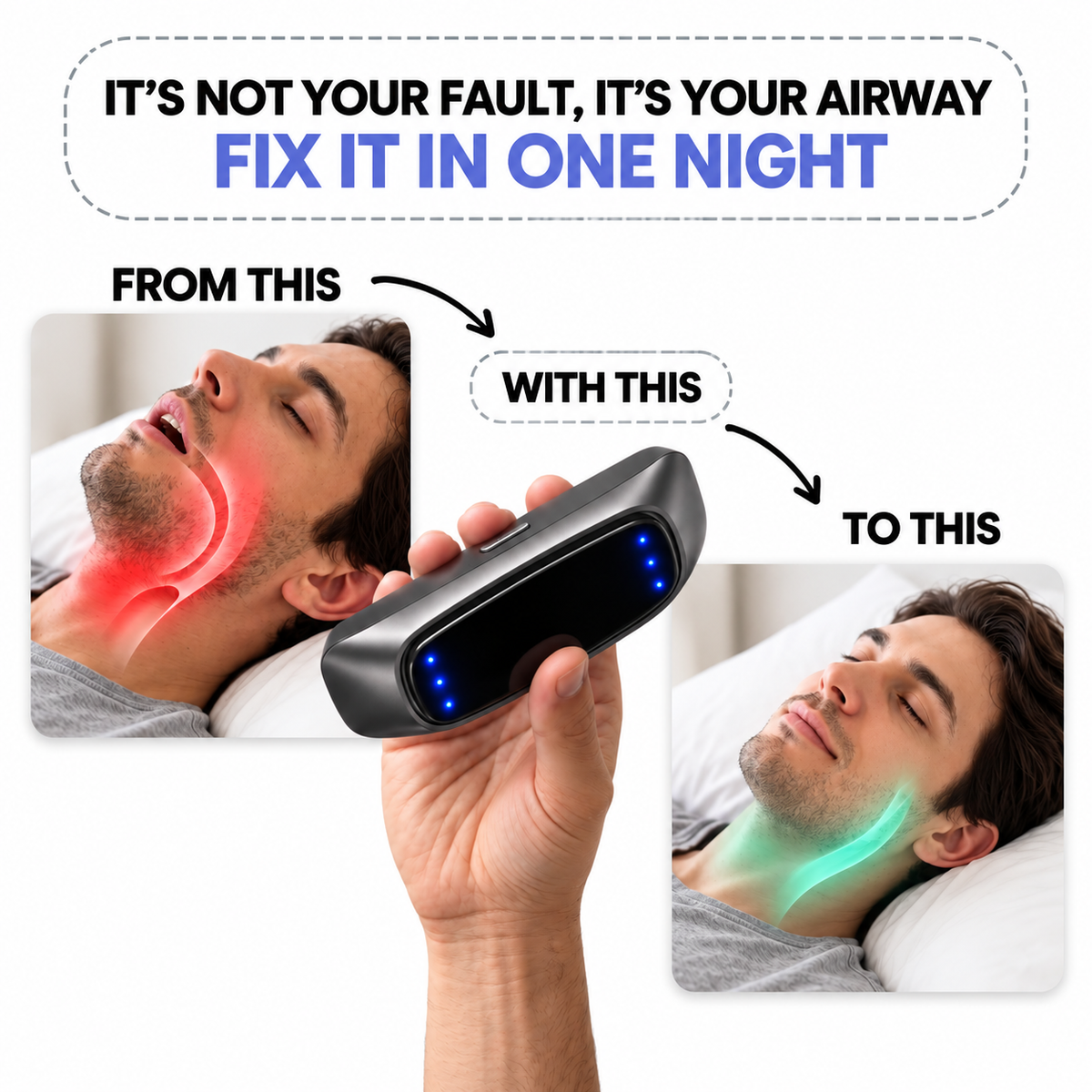 Smart Anti Snoring Device